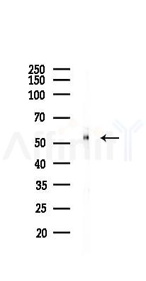 KLF4 Recombinant Rabbit mAb - Western blot analysis of lysates from Hela cells(LPS, 4h treatment), using KLF4 Recombinant Rabbit mAb at 1/1000 dilution.