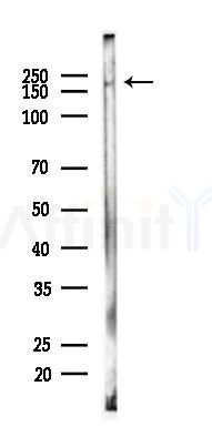 Phospho-HER2/ErbB2 (Tyr1221/Tyr1222) Recombinant Rabbit mAb - Western blot analysis of lysates from Rat brain, using Phospho-ErbB 2 (Tyr1221/Tyr1222) Recombinant Rabbit mAb at 1/1000 dilution.