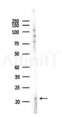IL11 Recombinant Rabbit mAb - Western blot analysis of lysates from Hela cells(UV 30min treatment), using IL-11 Recombinant Rabbit mAb at 1/1000 dilution.