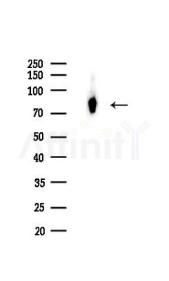 PDCD6IP Recombinant Rabbit mAb - Western blot analysis of lysates from Mouse liver, using ALIX Recombinant Rabbit mAb at 1/1000 dilution.