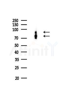 PDCD6IP Recombinant Rabbit mAb - Western blot analysis of lysates from B16F10-LUC cells(LPS,4h treatment), using ALIX Recombinant Rabbit mAb at 1/1000 dilution.