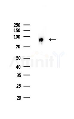 PDCD6IP Recombinant Rabbit mAb - Western blot analysis of lysates from Hela cells(LPS,4h treatment), using ALIX Recombinant Rabbit mAb at 1/1000 dilution.