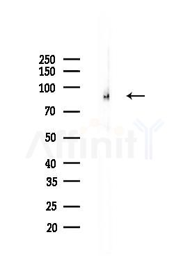 PDCD6IP Recombinant Rabbit mAb - Western blot analysis of lysates from Rat heart, using ALIX Recombinant Rabbit mAb at 1/1000 dilution.