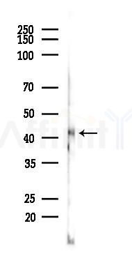 CCR3 Recombinant Rabbit mAb - Western blot analysis of lysates from Rat brain, using CCR3 Recombinant Rabbit mAb at 1/1000 dilution.