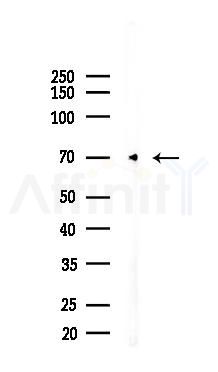 HAVCR2 Recombinant Rabbit mAb - Western blot analysis of lysates from HUVEC cells(starvation,24h treatment), using TIM 3 Recombinant Rabbit mAb at 1/1000 dilution.
