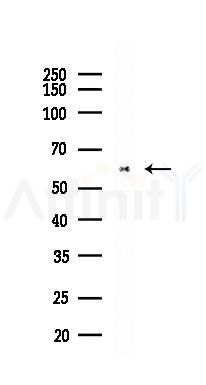 Cytokeratin 5 Recombinant Rabbit mAb - Western blot analysis of lysates from Mouse lung, using Cytokeratin 5 Recombinant Rabbit mAb at 1/1000 dilution.