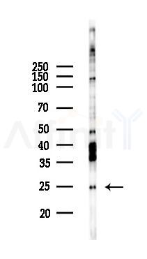 FNDC5 Recombinant Rabbit mAb - Western blot analysis of lysates from COLO205 cells(heat-shock,45min treatment), using FNDC5 Recombinant Rabbit mAb at 1/1000 dilution.