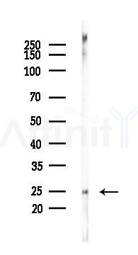 FNDC5 Recombinant Rabbit mAb - Western blot analysis of lysates from Rat muscle, using FNDC5 Recombinant Rabbit mAb at 1/1000 dilution.