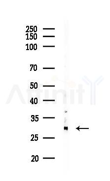 Cathepsin D Recombinant Rabbit mAb - Western blot analysis of lysates from A375 cells(heat-shock,45min treatment), using Cathepsin D Recombinant Rabbit mAb at 1/1000 dilution.