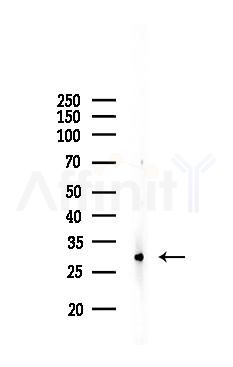 Cathepsin D Recombinant Rabbit mAb - Western blot analysis of lysates from COLO205 cells(LPS, 4h treatment), using Cathepsin D Recombinant Rabbit mAb at 1/1000 dilution.
