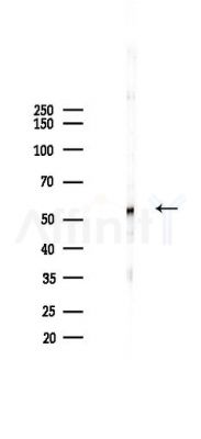 CLU Recombinant Rabbit mAb - Western blot analysis of lysates from Hela cells(heat-shock 45min treatment), using Clusterin Recombinant Rabbit mAb at 1/1000 dilution.