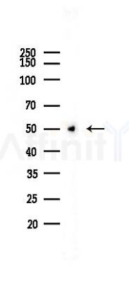 PGF Recombinant Rabbit mAb - Western blot analysis of lysates from B16F10-LUC cells(LPS,4h treatment), using PLGF Rabbit mAb at 1/1000 dilution.