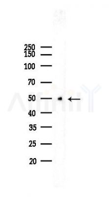 PGF Recombinant Rabbit mAb - Western blot analysis of lysates from HepG2 cells(heat-shock,45min treatment), using PLGF Rabbit mAb at 1/1000 dilution.
