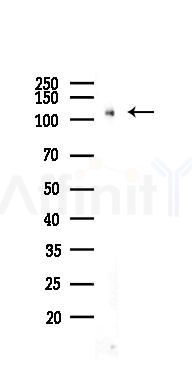 ERK5 Recombinant Rabbit mAb - Western blot analysis of lysates from Rat lung, using ERK5 Recombinant Rabbit mAb at 1/1000 dilution.