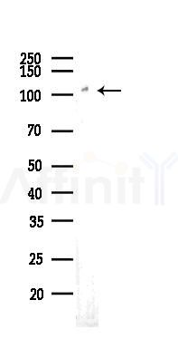 ERK5 Recombinant Rabbit mAb - Western blot analysis of lysates from A2780 cells(LPS 4h treatment), using ERK5 Recombinant Rabbit mAb at 1/1000 dilution.