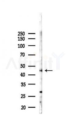 IL11RA Recombinant Rabbit mAb - Western blot analysis of lysates from PC12 cells(LPS,4h treatment), using IL-11RA Recombinant Rabbit mAb at 1/1000 dilution.