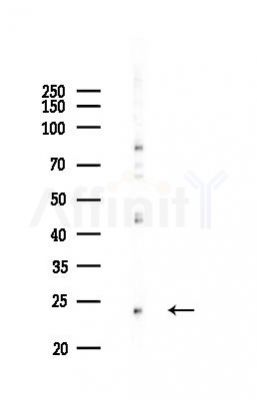 Bak Recombinant Rabbit mAb - Western blot analysis of lysates from EC304 cells(LPS,4h treatment), using Bak Rabbit mAb at 1/1000 dilution.