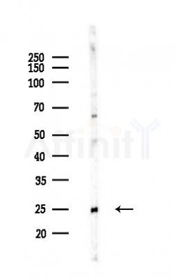 Bak Recombinant Rabbit mAb - Western blot analysis of lysates from A375 cells(heat-shock,45min treatment), using Bak Rabbit mAb at 1/1000 dilution.