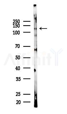 HDAC6 Recombinant Rabbit mAb - Western blot analysis of lysates from Rat brain, using HDAC6 Recombinant Rabbit mAb at 1/1000 dilution.