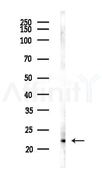 MGMT Recombinant Rabbit mAb - Western blot analysis of lysates from Mouse testis, using MGMT Recombinant Rabbit mAb at 1/1000 dilution.