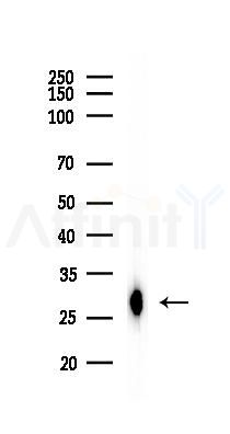 Galectin 3 Recombinant Rabbit mAb - Western blot analysis of lysates from A375 cells(heat-shock,45min treatment), using Galectin 3 Recombinant Rabbit mAb at 1/1000 dilution.