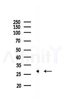 Galectin 3 Recombinant Rabbit mAb - Western blot analysis of lysates from COLO205 cells(LPS, 4h treatment), using Galectin 3 Recombinant Rabbit mAb at 1/1000 dilution.