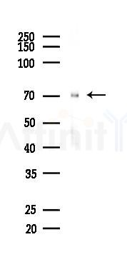 HSD11B1 Recombinant Rabbit mAb - Western blot analysis of lysates from Rat brain, using HSD11B1 Recombinant Rabbit mAb at 1/1000 dilution.