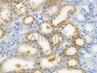 HSD11B1 Recombinant Rabbit mAb - BF3648 at 1/100 staining human normal kidney tissue by IHC-P.