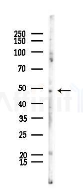 HDAC3 Recombinant Rabbit mAb - Western blot analysis of lysates from LoVo cells(heat-shock,45min treatment), using HDAC3 Recombinant Rabbit mAb at 1/1000 dilution.