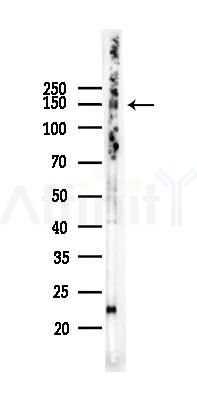 Integrin  alpha 5 Recombinant Rabbit mAb - Western blot analysis of lysates from HepG2 cells(heat-shock,45min treatment), using Integrin alpha 5 Rabbit mAb at 1/1000 dilution.