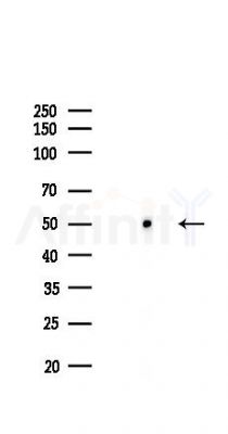 NSE Recombinant Rabbit mAb - Western blot analysis of lysates from COLO205 cells(LPS,4h treatment), using NSE Recombinant Rabbit mAb at 1/1000 dilution.