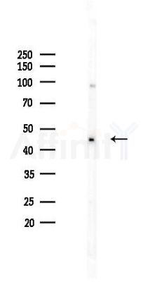 NSE Recombinant Rabbit mAb - Western blot analysis of lysates from HepG2 cells(heat-shock,45min treatment), using NSE Recombinant Rabbit mAb at 1/1000 dilution.