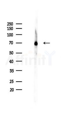 Hsc70 Recombinant Rabbit mAb - Western blot analysis of lysates from HepG2 cells(heat-shock,45min treatment), using Hsc70 Recombinant Rabbit mAb at 1/1000 dilution.