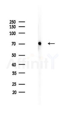 Hsc70 Recombinant Rabbit mAb - Western blot analysis of lysates from Rat lung, using Hsc70 Recombinant Rabbit mAb at 1/1000 dilution.