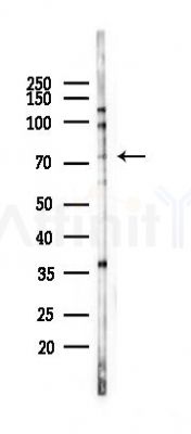 Phospho-PKR (Thr446) Recombinant Rabbit mAb - Western blot analysis of lysates from HUVEC cells(heat-shock 45min treatment), using Phospho-PKR (Thr446) Recombinant Rabbit mAb at 1/1000 dilution.