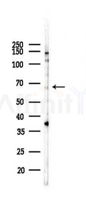 Phospho-PKR (Thr446) Recombinant Rabbit mAb - Western blot analysis of lysates from A2780 cells(LPS 4h treatment), using Phospho-PKR (Thr446) Recombinant Rabbit mAb at 1/1000 dilution.