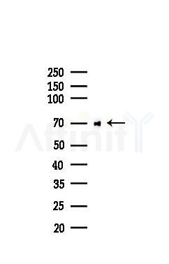 PKR Recombinant Rabbit mAb - Western blot analysis of lysates from HUVEC cells(LPS,4h treatment), using PKR Recombinant Rabbit mAb at 1/1000 dilution.