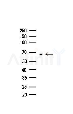 PKR Recombinant Rabbit mAb - Western blot analysis of lysates from COLO205 cells(heat-shock,45min treatment), using PKR Recombinant Rabbit mAb at 1/1000 dilution.