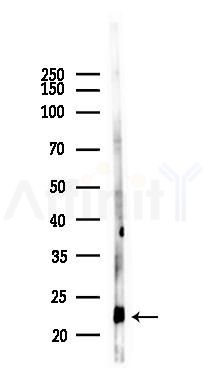 Dermatopontin Recombinant Rabbit mAb - Western blot analysis of lysates from Rat testis, using DPT/TRAMP Recombinant Rabbit mAb at 1/1000 dilution.