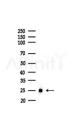 KGF Recombinant Rabbit mAb - Western blot analysis of lysates from B16F10-LUC cells(starvation,24h treatment), using KGF Recombinant Rabbit mAb at 1/1000 dilution.