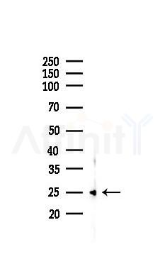 KGF Recombinant Rabbit mAb - Western blot analysis of lysates from PC12 cells(LPS,4h treatment), using KGF Recombinant Rabbit mAb at 1/1000 dilution.