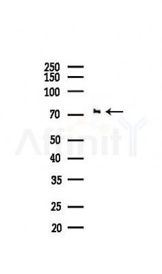 CPT2 Recombinant Rabbit mAb - Western blot analysis of lysates from Mouse liver, using CPT2 Recombinant Rabbit mAb at 1/1000 dilution.
