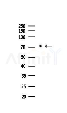 CPT2 Recombinant Rabbit mAb - Western blot analysis of lysates from Rat lung, using CPT2 Recombinant Rabbit mAb at 1/1000 dilution.