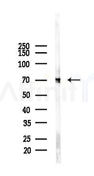 ABCG5 Recombinant Rabbit mAb - Western blot analysis of lysates from Mouse brain, using ABCG5 Recombinant Rabbit mAb at 1/1000 dilution.
