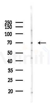 ABCG5 Recombinant Rabbit mAb - Western blot analysis of lysates from EC304 cells(LPS, 4h treatment), using ABCG5 Recombinant Rabbit mAb at 1/1000 dilution.