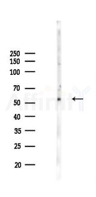 Chk1 Recombinant Rabbit mAb - Western blot analysis of lysates from COLO205 cells(LPS,4h treatment), using Chk1 Recombinant Rabbit mAb at 1/1000 dilution.
