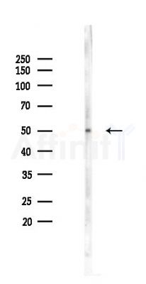Chk1 Recombinant Rabbit mAb - Western blot analysis of lysates from HepG2 cells(heat-shock,45min treatment), using Chk1 Recombinant Rabbit mAb at 1/1000 dilution.