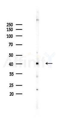PGK1 Recombinant Rabbit mAb - Western blot analysis of lysates from HepG2 cells(heat-shock,45min treatment), using PGK1 Recombinant Rabbit mAb at 1/1000 dilution.