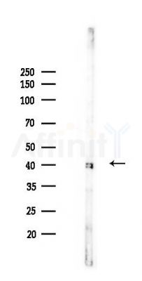 PGK1 Recombinant Rabbit mAb - Western blot analysis of lysates from Mouse brain, using PGK1 Recombinant Rabbit mAb at 1/1000 dilution.