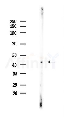 PGK1 Recombinant Rabbit mAb - Western blot analysis of lysates from Rat lung, using PGK1 Recombinant Rabbit mAb at 1/1000 dilution.